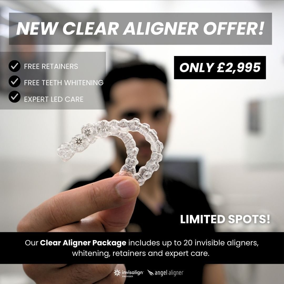 STILL POST OFFER